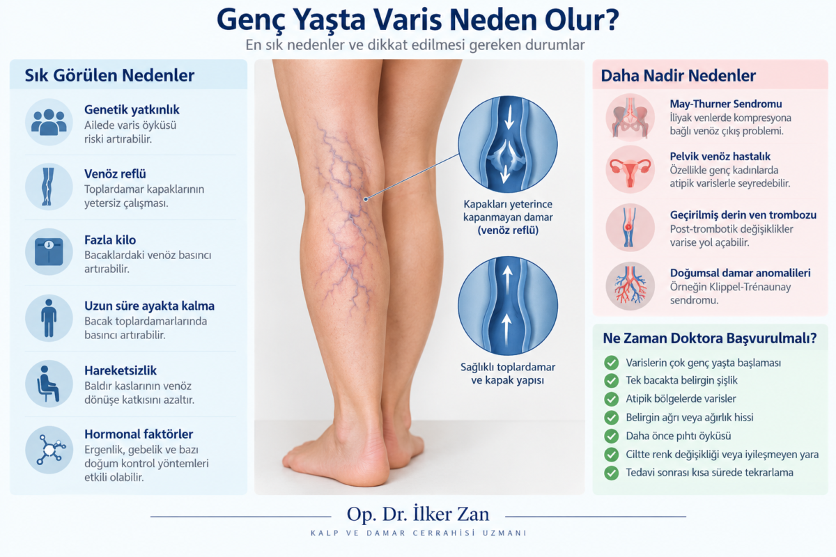 Genç yaşta varis neden olur? Genetik yatkınlık, venöz reflü ve genç yaşta varise yol açabilen diğer faktörler