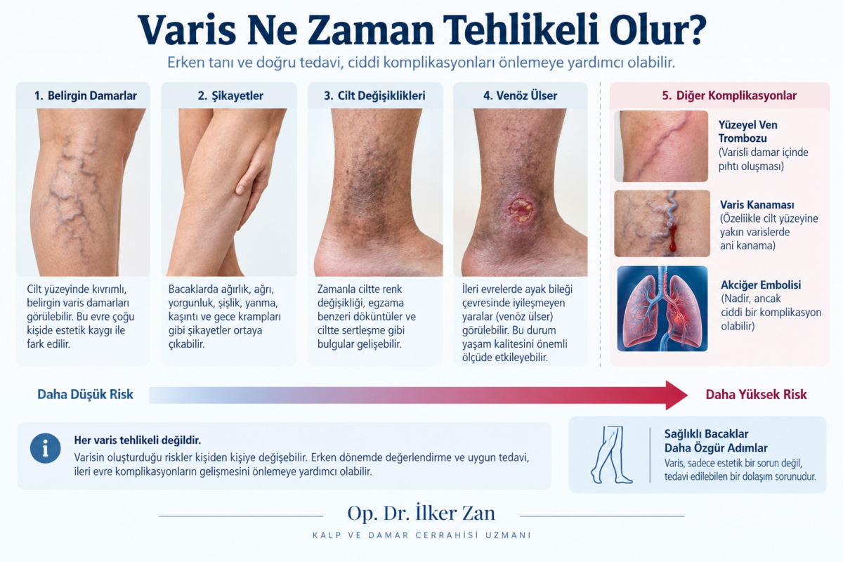 Varis ne zaman tehlikeli olur? Varisin belirtileri ve olası komplikasyonları
