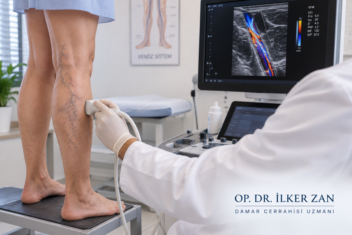 Antalya varis doktoru seçerken uzmanlık, renkli Doppler ultrason, tedavi seçenekleri ve hasta iletişiminin önemini gösteren tıbbi görse