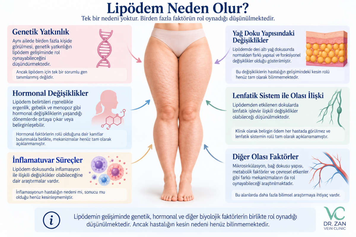 Lipödem neden olur ve lipödem nedenleri