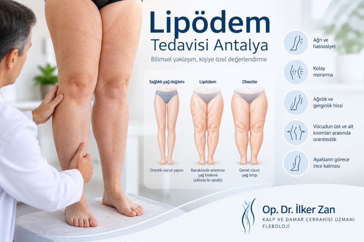 Lipödemde bacaklarda orantısız yağ dağılımını ve sağlıklı yağ dağılımı ile obezite arasındaki görsel farkları gösteren tıbbi görsel