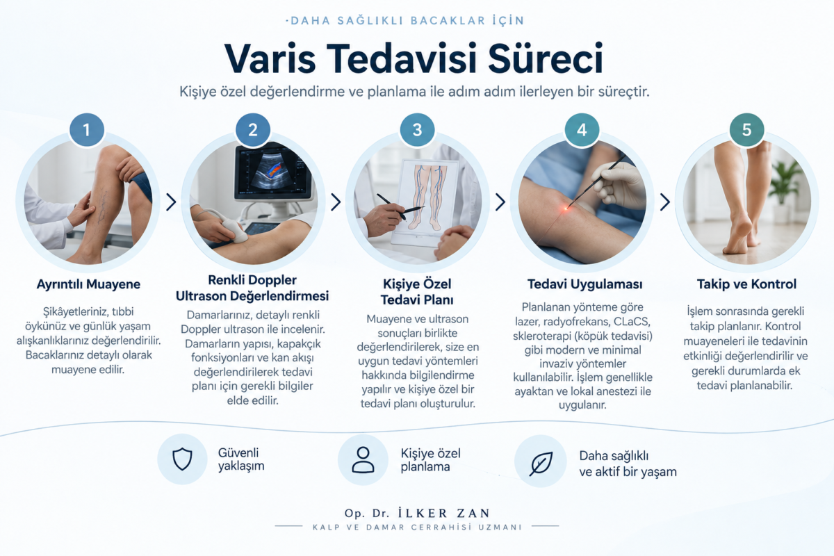 Antalya'da varis tedavisi sürecinin muayene, renkli Doppler ultrason, tedavi planı, uygulama ve kontrol aşamaları